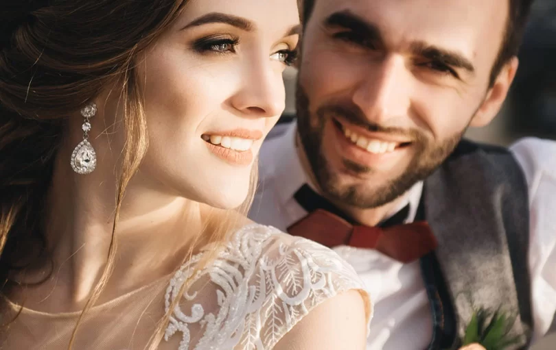 wedding smile makeover